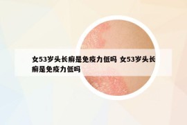 女53歲頭長(zhǎng)癬是免疫力低嗎 女53歲頭長(zhǎng)癬是免疫力低嗎