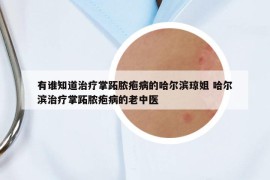 有誰知道治療掌跖膿皰病的哈爾濱瓊姐 哈爾濱治療掌跖膿皰病的老中醫(yī)