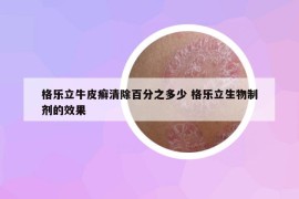 格樂(lè)立牛皮癬清除百分之多少 格樂(lè)立生物制劑的效果