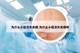 為什么小菇?jīng)鲩L皮癬 為什么小菇?jīng)鲩L皮癬呢