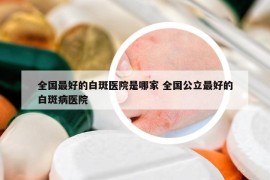 全國最好的白斑醫(yī)院是哪家 全國公立最好的白斑病醫(yī)院
