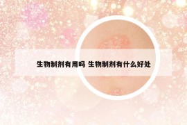 生物制劑有用嗎 生物制劑有什么好處
