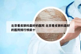 北京看皮膚科最好的醫(yī)院 北京看皮膚科最好的醫(yī)院排行榜前十