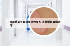 銀屑病關節(jié)炎父親遺傳女兒 關節(jié)型銀屑病遺傳