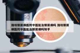 濰坊銀屑病醫(yī)院中醫(yī)能治銀屑病嗎 濰坊銀屑病醫(yī)院中醫(yī)能治銀屑病嗎知乎