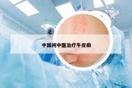 中國純中醫(yī)治療牛皮癬