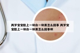 兩歲寶寶臉上一塊白一塊黑怎么回事 兩歲寶寶臉上一塊白一塊黑怎么回事啊
