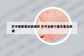 巴中哪里看皮膚病好 巴中治哪個(gè)醫(yī)生看皮膚病