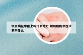 銀屑病在中醫(yī)上叫什么地方 銀屑病的中醫(yī)診斷叫什么