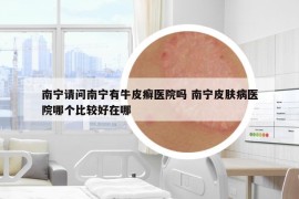 南寧請問南寧有牛皮癬醫(yī)院嗎 南寧皮膚病醫(yī)院哪個比較好在哪