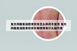 復(fù)方丙酸氯倍他索軟膏怎么停藥不復(fù)發(fā) 復(fù)方丙酸氯倍他索軟膏長期使用有什么副作用