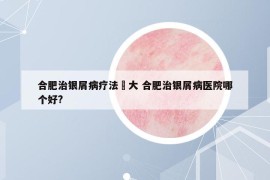 合肥治銀屑病療法軍大 合肥治銀屑病醫(yī)院哪個好?