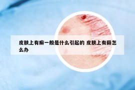 皮膚上有癬一般是什么引起的 皮膚上有蘚怎么辦