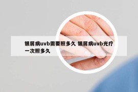 銀屑病uvb需要照多久 銀屑病uvb光療一次照多久