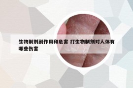 生物制劑副作用和危害 打生物制劑對(duì)人體有哪些傷害