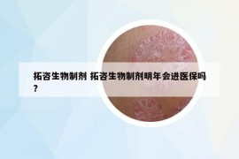 拓咨生物制劑 拓咨生物制劑明年會進醫(yī)保嗎?