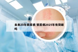 未來20年銀屑病 銀屑病2025年有突破嗎