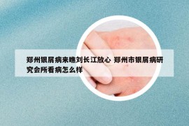 鄭州銀屑病來瞧劉長江放心 鄭州市銀屑病研究會(huì)所看病怎么樣