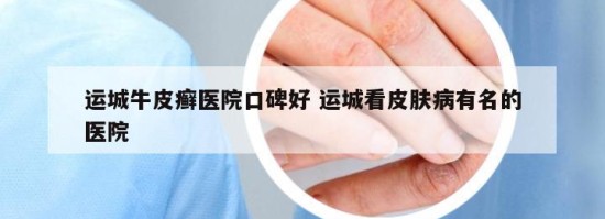 運(yùn)城牛皮癬醫(yī)院口碑好 運(yùn)城看皮膚病有名的醫(yī)院