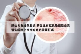 新生兒有紅色胎記 新生兒有紅色胎記能自己消失嗎晚上寶寶吃完奶需要打嗝