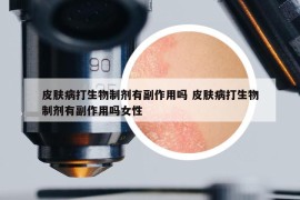 皮膚病打生物制劑有副作用嗎 皮膚病打生物制劑有副作用嗎女性