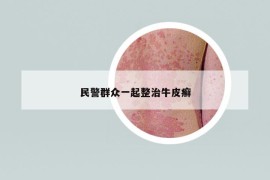 民警群眾一起整治牛皮癬