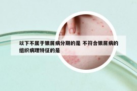 以下不屬于銀屑病分期的是 不符合銀屑病的組織病理特征的是