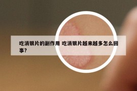 吃消銀片的副作用 吃消銀片越來越多怎么回事?