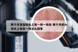兩個(gè)月寶寶和頭上有一塊一塊白 兩個(gè)月的小孩頭上有白一塊怎么回事