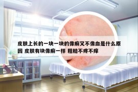 皮膚上長(zhǎng)的一塊一塊的像癬又不像血是什么原因 皮膚有塊像癬一樣 粗糙不疼不癢