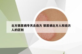北方銀屑病冬天去南方 銀屑病北方人和南方人的區(qū)別
