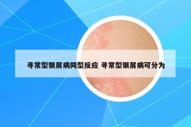 尋常型銀屑病同型反應(yīng) 尋常型銀屑病可分為