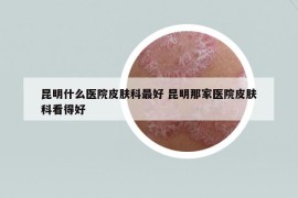 昆明什么醫(yī)院皮膚科最好 昆明那家醫(yī)院皮膚科看得好