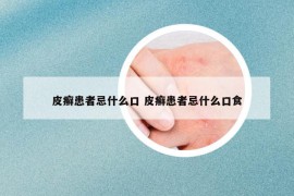 皮癬患者忌什么口 皮癬患者忌什么口食