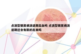 點滴型銀屑病消退期出血嗎 點滴型銀屑病消退期還會有新的出來嗎