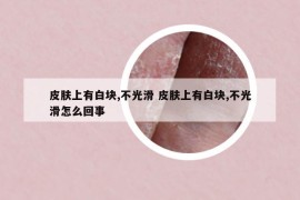 皮膚上有白塊,不光滑 皮膚上有白塊,不光滑怎么回事