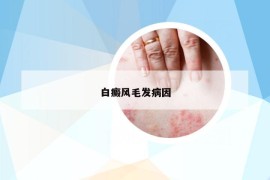白癜風(fēng)毛發(fā)病因