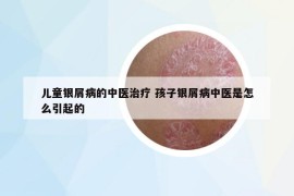 兒童銀屑病的中醫(yī)治療 孩子銀屑病中醫(yī)是怎么引起的