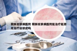 朝鮮皮膚病醫(yī)院 朝鮮皮膚病醫(yī)院能治療能激光治療絲狀疣嗎