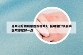 昆明治療銀屑病醫(yī)院哪家好 昆明治療銀屑病醫(yī)院哪家好一點(diǎn)