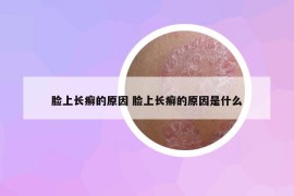 臉上長癬的原因 臉上長癬的原因是什么