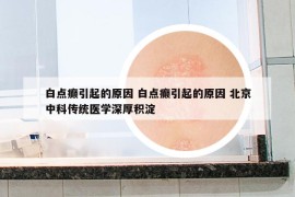 白點(diǎn)癲引起的原因 白點(diǎn)癲引起的原因 北京中科傳統(tǒng)醫(yī)學(xué)深厚積淀
