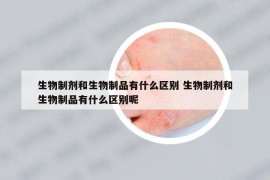 生物制劑和生物制品有什么區(qū)別 生物制劑和生物制品有什么區(qū)別呢