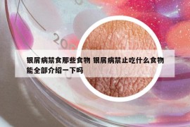 銀屑病禁食那些食物 銀屑病禁止吃什么食物能全部介紹一下嗎
