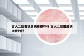 吉大二院看銀屑病看得咋樣 吉大二院銀屑病誰看的好