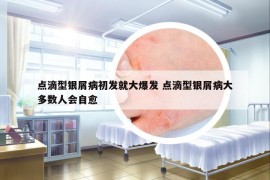 點(diǎn)滴型銀屑病初發(fā)就大爆發(fā) 點(diǎn)滴型銀屑病大多數(shù)人會自愈