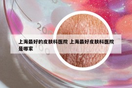 上海最好的皮膚科醫(yī)院 上海最好皮膚科醫(yī)院是哪家