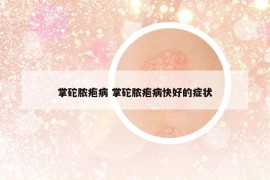 掌砣膿皰病 掌砣膿皰病快好的癥狀