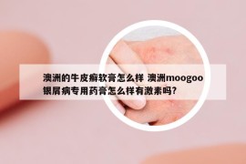 澳洲的牛皮癬軟膏怎么樣 澳洲moogoo銀屑病專用藥膏怎么樣有激素嗎?