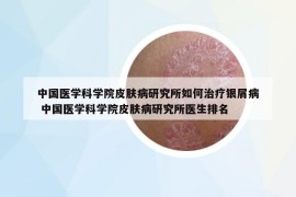 中國醫(yī)學(xué)科學(xué)院皮膚病研究所如何治療銀屑病 中國醫(yī)學(xué)科學(xué)院皮膚病研究所醫(yī)生排名